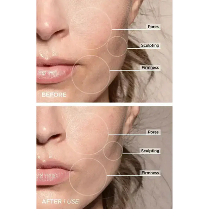 ZENVORA 7-in-1 LED Facial Sculptor